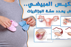 التكيس المبيضي عند النساء وتأثيره على الحمل
