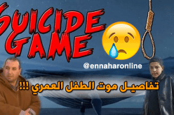 والد الطفل العمري يكشف ظهور كدمات في يد إبنه اليمنى
