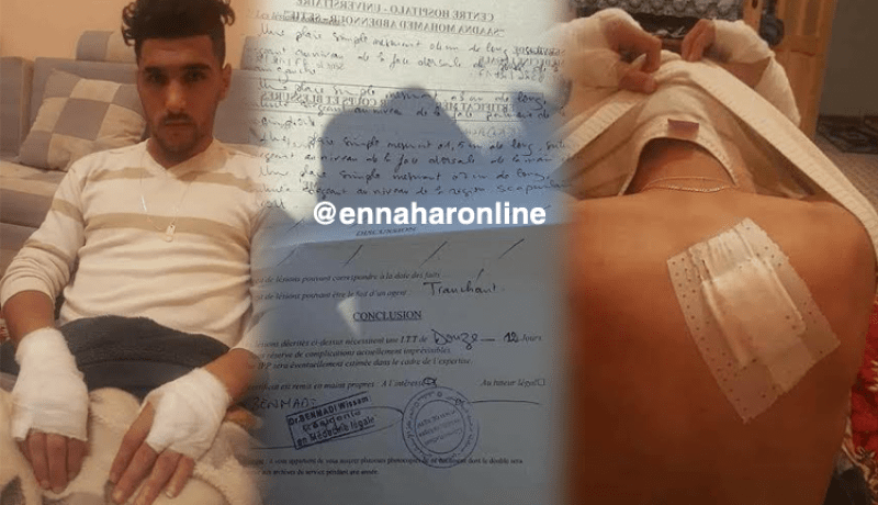 لاعب شبيبة سكيكدة مقداش يتعرض إلى اعتداء بالخنجر في سطيف!