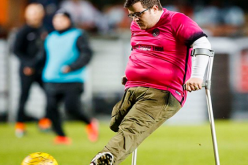 بالصورة والفيديو..  مشجع برجل واحدة يفوز بجائزة أفضل هدف في أسكتلندا