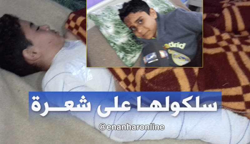 بالصور ..صعقة كهربائية تدخل شقيقان الإستعجالات الطبية بالوادي