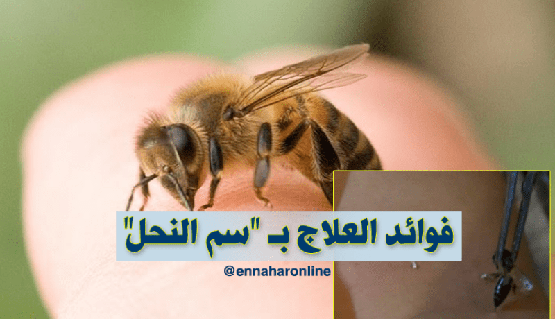 العلاج بسم النحل..علاج فعال لكثير من الأمراض