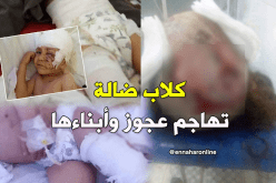 بالصور.. كلاب مسعورة تهاجم عجوز مع أبنائها الثلاث في المنيعة بغرداية