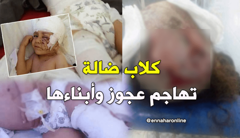 بالصور.. كلاب مسعورة تهاجم عجوز مع أبنائها الثلاث في المنيعة بغرداية