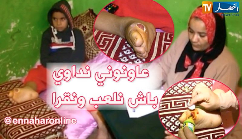 أم تناشد السلطات لعلاج فلذة كبدها بعين تيموشنت