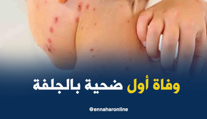 الجلفة.. وفاة أول ضحية بالبوحمرون وتواجد إمراة في حالة حرجة بمستشفى عين وسارة