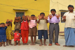 بالصور.. عائلة هندية مختلفة حيّرت العلماء