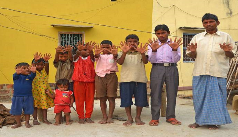 بالصور.. عائلة هندية مختلفة حيّرت العلماء