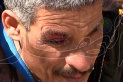 51 كفيفا فقدوا مناصب عملهم في أم البواقي