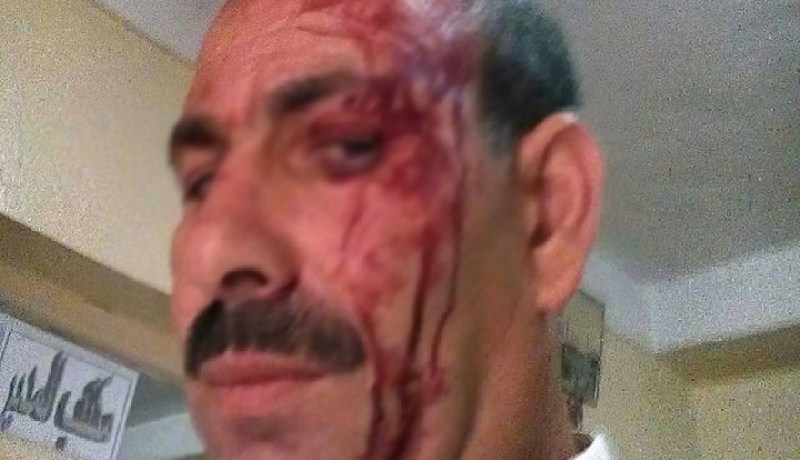 خنشلة..مواطن يعتدي على مدير مدرسة رفض بيعه كتبا
