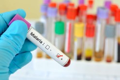 داء الملاريا.. الأعراض والوقاية والعلاج