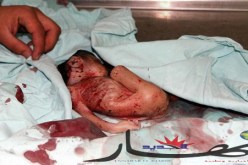 عجوز ومراقب طبي يقودان شبكة متخصّصة في عمليات الإجهـاض بتــيبازة