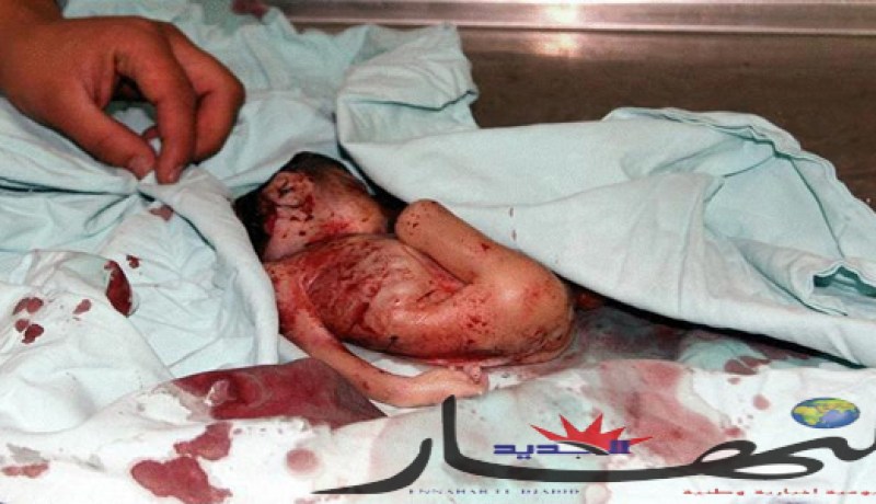 عجوز ومراقب طبي يقودان شبكة متخصّصة في عمليات الإجهـاض بتــيبازة