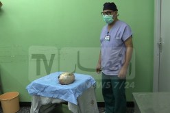 بالصور.. فريق طبي شاب ينجح في استئصال ورم كيسي وزنه 4 كلغ من بطن عجوز بباتنة