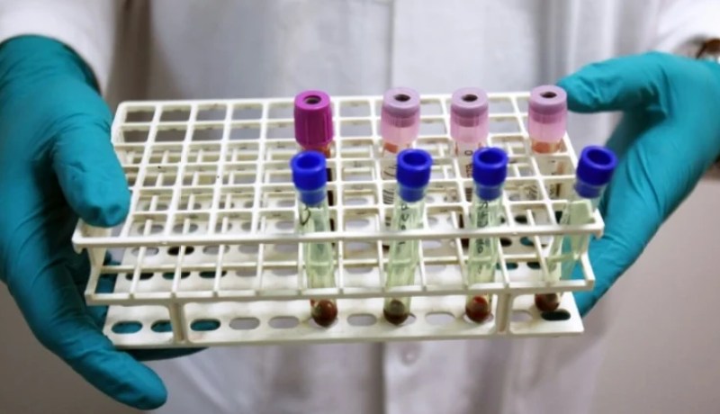 أولمبياد لندن 2012 : اكتشاف 23 حالة منشطات لرياضيين من 6 دول في 5 رياضات