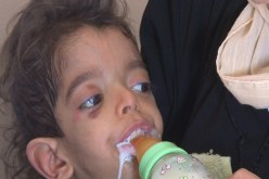 حقنة‮ ''‬فاليوم‮''‬من طبيب بمستشفى بني‮ ‬مسوس توقف نمو‮ ''‬سيف الدين‮''‬