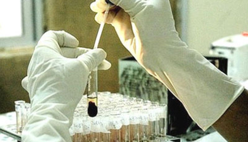 اكتشاف علاج جديد للسيدا يحول دون وفاة 10 ملايين مصاب سنويا بحلول 2025