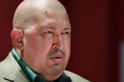 تشافيز فى حالة حرجة و معقدة بعد الجراحة