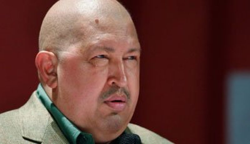 تشافيز فى حالة حرجة و معقدة بعد الجراحة