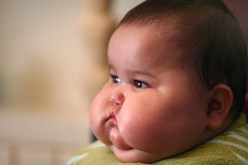 75 % من الأطفال الذين يعانون من زيادة الوزن يوجدون في الدول النامية