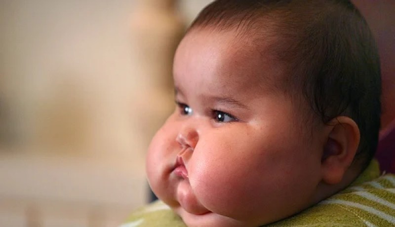 75 % من الأطفال الذين يعانون من زيادة الوزن يوجدون في الدول النامية