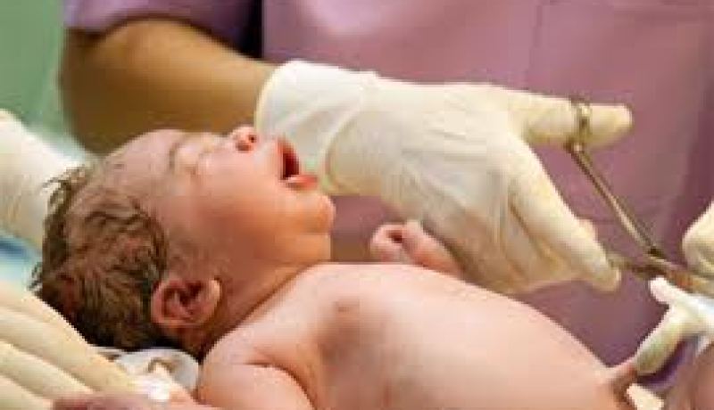 تأخير قطع حبل السرة ولو لدقيقة واحدة مفيد لصحة الطفل والأم