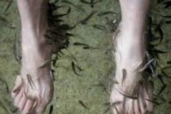 أسماك تعالج الصدفية وتتغذى على الجلد الميت