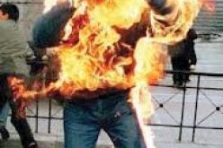 وفاة شاب متأثرا بحروق من الدرجة الثالثة في البويرة