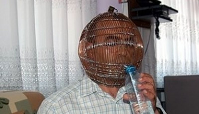 للإقلاع عن التدخين.. رجل تركي يضع رأسه في قفص