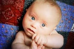 الدعوة إلى مرافقة المصابين بالتثلث الصبغي لتمكينهم من تحقيق الاستقلالية التامة