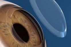 التوقف عن إستيراد القرنية أدى إلى تراجع عملية زرع هذا العضو