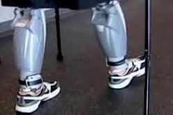 زرع أعضاء اصطناعية لمعاقين حركيا بالمجان خلال الأيام الطبية الجراحية بأولاد جلال في بسكرة