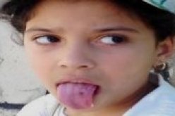 البنت الصغيرة آية التي تخرج شعرا من فمها تدخل المركز الاستشفائي الجامعي لعنابة