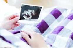 تسجيل عدة حالات للحمل المتعدد خلال السنوات الأخيرة