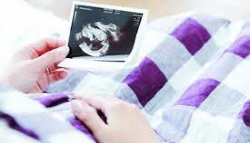 تسجيل عدة حالات للحمل المتعدد خلال السنوات الأخيرة