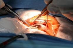 اجراء اول عملية لزرع الشبكية على مستوى ولاية البليدة الاسبوع المقبل