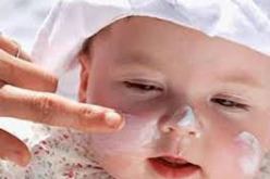 المؤسسة الإستشفائية المتخصصة للجزائر العاصمة تتكفل سنويا ب 6000 حالة استعجالية لحروق الأطفال