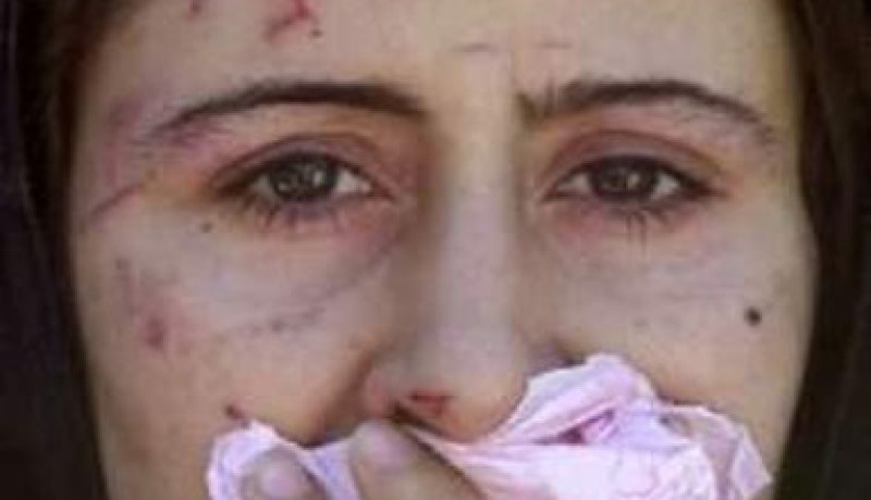 الدعوة إلى التخلص من جميع أشكال العنف ضد النساء والبنات والوقاية منها