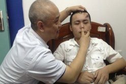 جراحون صينيون ينجحون في زراعة أنف في جبين شاب صيني