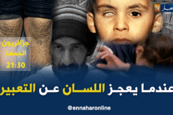 مرض نادر يصيب عائلة ومعوقة ضحية وحوش بشرية