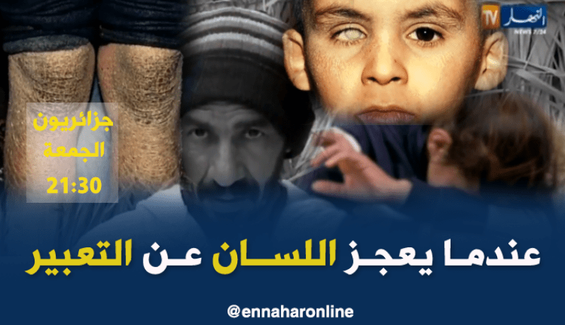 مرض نادر يصيب عائلة ومعوقة ضحية وحوش بشرية