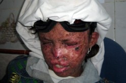 الطفلة ” آمال” تصارع الداء وتستنجد بذوي القلوب الرحيمة