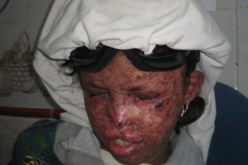 “إيمان” تستنجد بذوي القلوب الرحيمة لإنقاذ بصرها