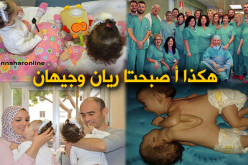 فصل توأمين جزائريين بمستشفى روما بإيطاليا