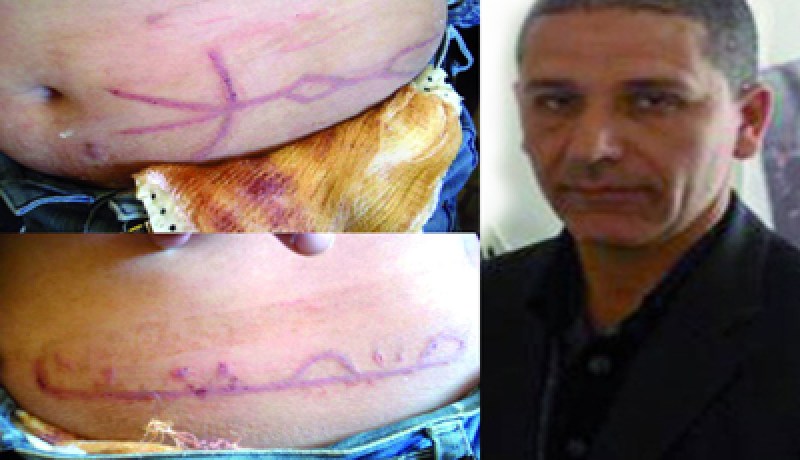 الـجزائري‮ ‬الـذي‮ ‬عـذبه الـمــصريون في‮ ‬إضـراب عـن الـطعـام‮ ‬غــدا