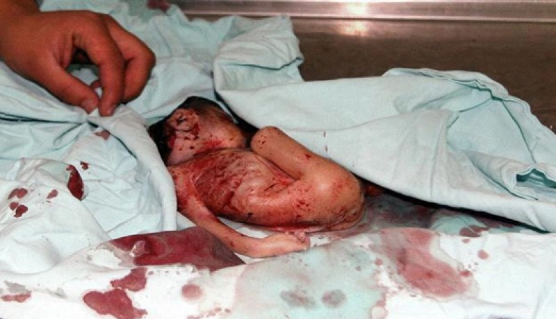 العثور على رضيع حديث الولادة بمفرغة عمومية في وهران