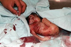 أزيد من 77 ألف ولادة غير شرعية : 80 ألف حالة إجهاض العام الفارط على المستوى الوطني