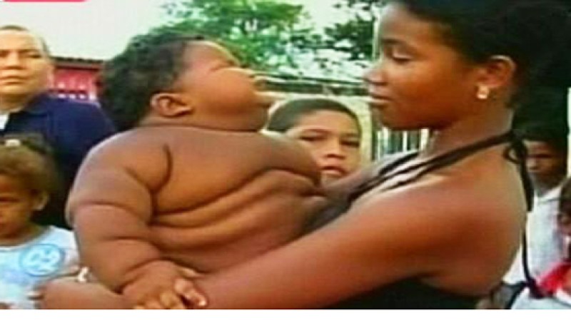 أضخم رضيع في العالم عمره 11 شهرا ووزنه 28 كلغ في كولومبيا