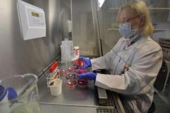 لغز بكتيريا إي كولاي لم يجد حلا بعد