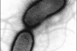 الاشتباه بثلاث اصابات ببكتيريا اي كولاي في الولايات المتحدة